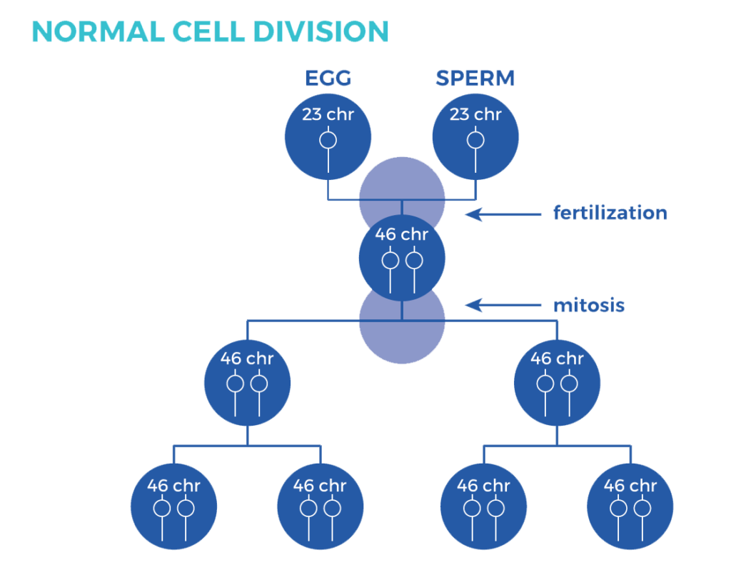 types-of-down-syndrome