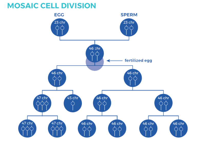 Types of Down Syndrome